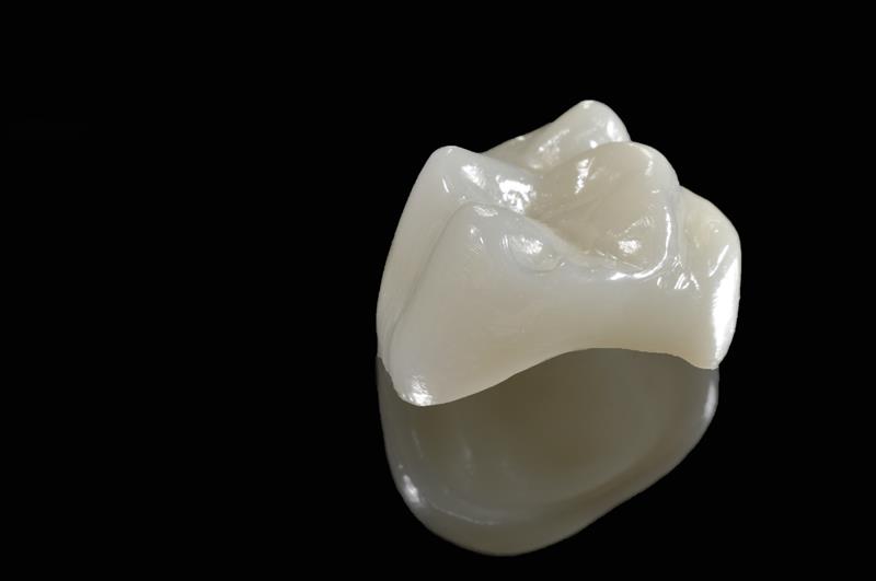 Porcelain Crowns Seattle, WA 
